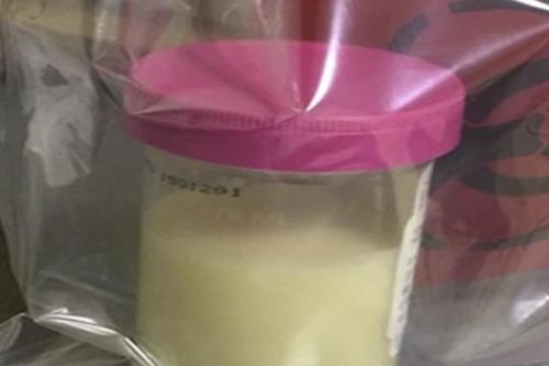 Người phụ nữ có nước tiểu trắng như sữa, đi khám giật mình khi biết có 'sinh vật lạ' ở trong