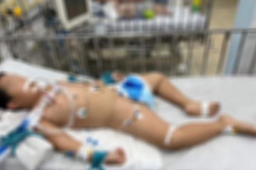 Cứu sống bé trai bị viêm não hoại tử hiếm gặp