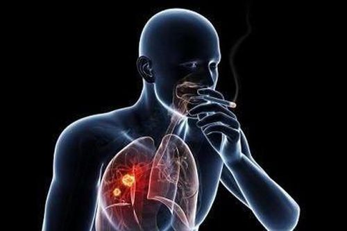 Hút thuốc lá làm tăng nguy cơ ung thư ở 10 bộ phận của cơ thể