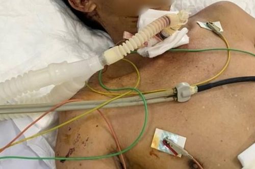 Quảng Nam: Cấp cứu kịp thời người đàn ông nghi dùng dao cắt cổ tự vẫn