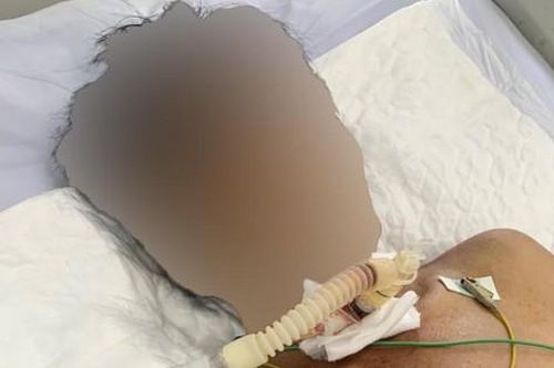 Quảng Nam: Cứu người đàn ông tự cứa cổ, đâm dao vào bụng