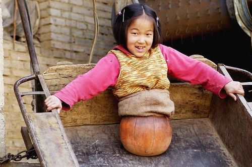 'Cô bé bóng rổ' bị cắt bỏ toàn bộ phần thân dưới ngày ấy bây giờ ra sao?