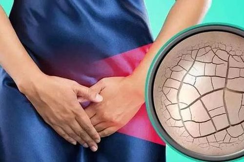 Không thể quan hệ tình dục do mắc chứng co thắt âm đạo