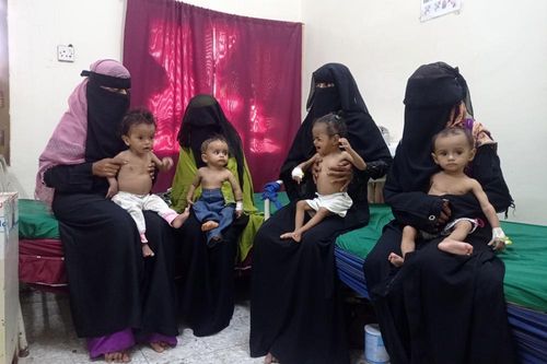 Trẻ em suy dinh dưỡng - hậu quả xung đột 'kép' ở Yemen