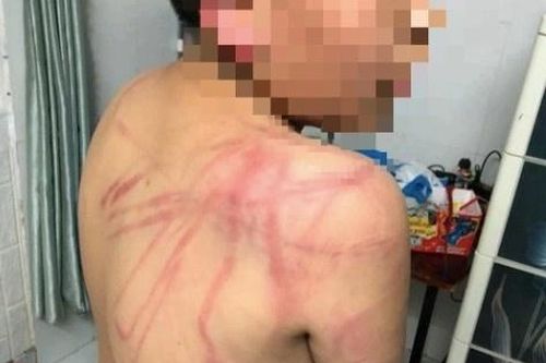 Bạo hành con ruột, cha đối diện hình phạt nào?