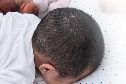 Liên tiếp trẻ nhỏ đột tử khi ngủ, cảnh báo hội chứng nguy hiểm