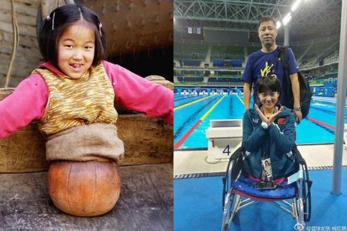 'Cô bé bóng rổ' mất nửa cơ thể ngày ấy giờ ra sao?
