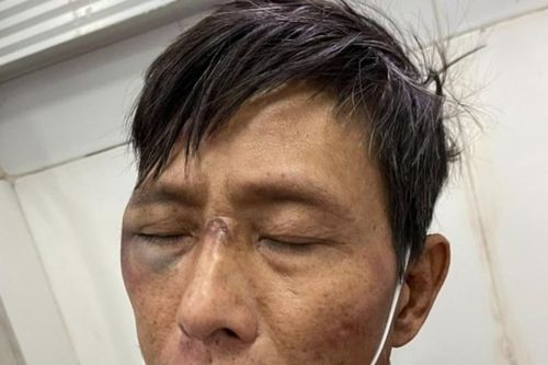 Hải Phòng: Bắt đối tượng vác rìu chém công an sau khi gây án