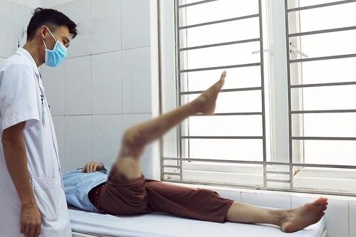 Ca nối bàn chân bị đứt lìa tại Vĩnh Phúc có kết quả phục hồi tốt