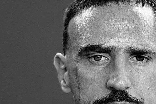 Câu chuyện đau lòng đằng sau những vết sẹo trên mặt của Ribery