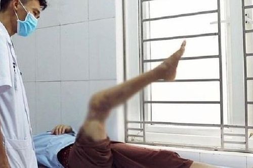 Nếu chẳng may phần chi đứt lìa làm sao để bảo quản đúng trước khi bệnh nhân đến viện?