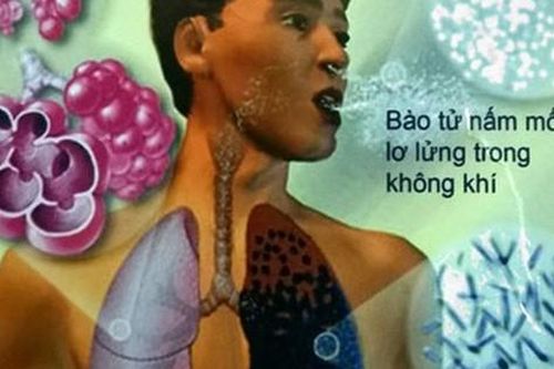 Bệnh nấm - mối đe dọa sức khỏe toàn cầu