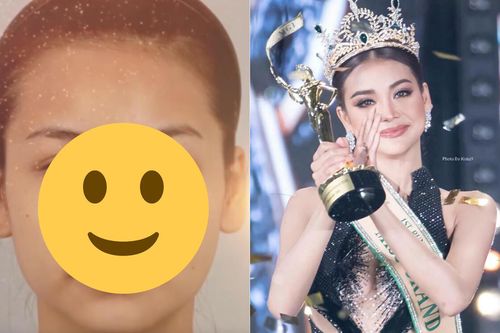 Netizen bất ngờ đào lại hình ảnh nhan sắc của Á hậu Engfa Waraha trước khi phẫu thuật thẩm mỹ