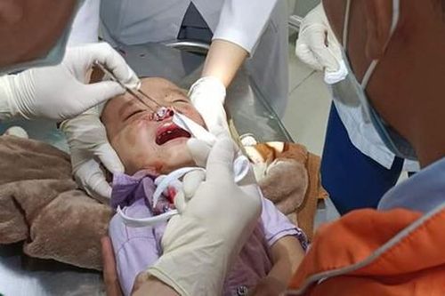 Làm rõ vụ người dân tố CSGT đánh cháu bé 3 tuổi nứt xương mặt
