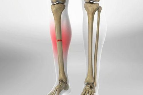 Phát hiện tế bào gốc giúp sửa chữa các chấn thương xương