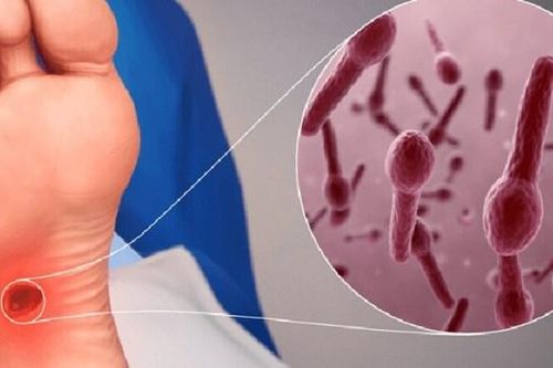 Suýt ngưng tim vì cọc nhọn đâm vào chân
