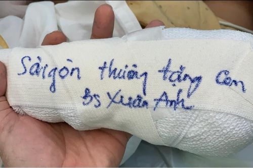 Bác sĩ TP.HCM 'tặng' em bé Hà Giang cả 'bàn tay'
