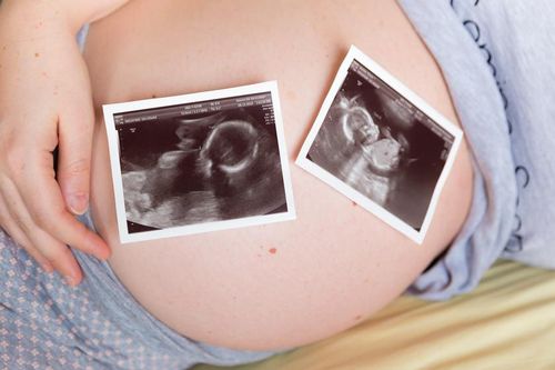 6 biến chứng nguy hiểm khi mang đa thai