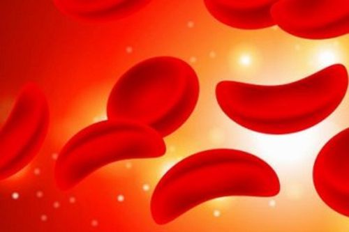 Hỗ trợ trẻ mắc bệnh SCD