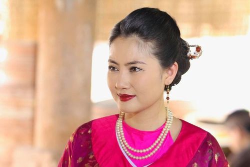Một sao nữ Vbiz gặp sự cố ở mắt, vừa lên đoàn phim đã bị 'đuổi về'