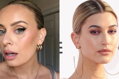 Hói đầu vì học cách búi tóc như Hailey Bieber