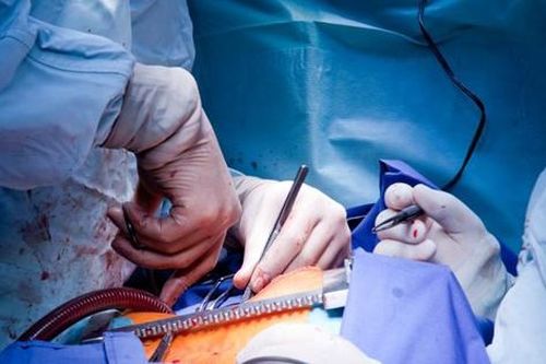 Tim của người hiến tặng mắc COVID-19 có thể sử dụng an toàn để cấy ghép