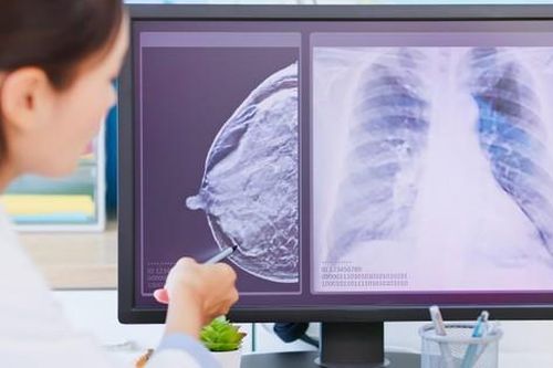 SPOT-MAS-công nghệ gen giúp phát hiện DNA tế bào ung thư trong máu