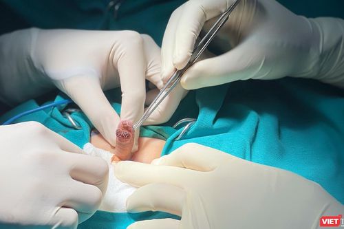 Hy hữu: Bé trai 6 tuổi suýt phải cắt cụt dương vật do sùi mào gà thể nặng