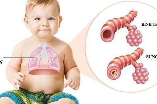 Viêm tiểu phế quản cấp ở trẻ khi thời tiết giao mùa