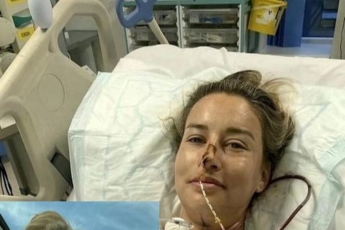 Đi khám nhiệt miệng, cô gái 27 tuổi phải cắt bỏ một nửa lưỡi vì ung thư