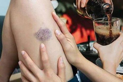 Loại đồ uống cần tránh ngay vì có thể dẫn đến cục máu đông đe dọa tính mạng