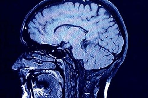 Phát hiện gene cần thiết cho sự phát triển não bộ