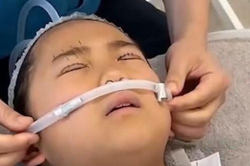 Ám ảnh sợ xấu, cô bé 9 tuổi phẫu thuật thẩm mỹ