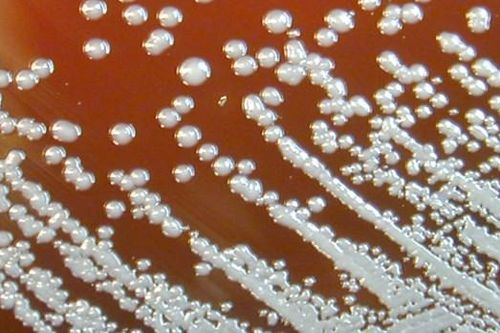 Thanh Hóa ra văn bản khẩn tăng cường phòng, chống bệnh Whitmore