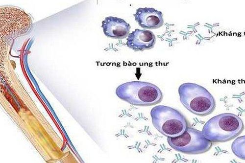 Thêm liệu pháp điều trị đa u tủy xương tái phát khó chữa