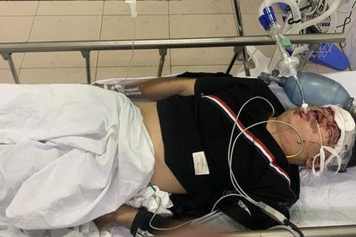 Hải Phòng: Xác minh vụ 5 thanh thiếu niên bị thương vong trong đêm