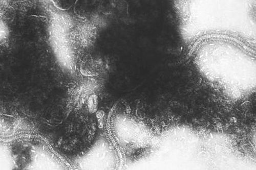 Phê duyệt thuốc dự phòng nhiễm virus hợp bào hô hấp ở trẻ
