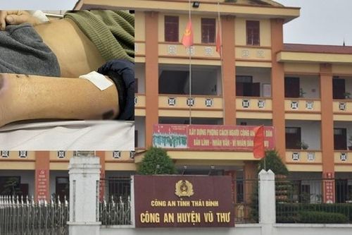 Cựu Đội trưởng, đội phó Công an Vũ Thư bị bắt: 'Dùng nhục hình' thế nào?