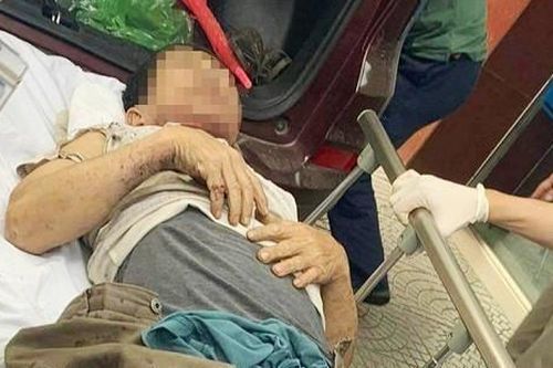 Khoan thùng phuy dầu cũ phát nổ, chủ doanh nghiệp bị thương nặng