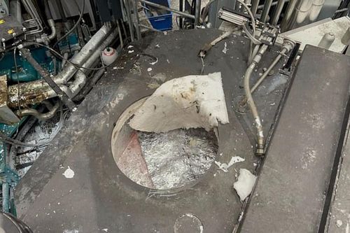 Một công nhân 25 tuổi sống sót thần kỳ sau khi rơi vào lò nung nhôm nóng 760 độ C