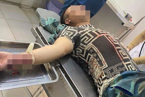 Tìm gặp hàng xóm 'bắt sâu' ở vòng một của vợ, chồng bị chém thương tích 37%