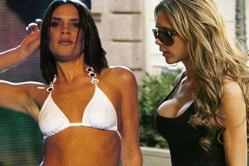 Victoria Beckham, Bella Hadid hối hận vì phẫu thuật thẩm mỹ
