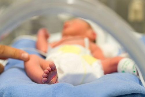 Sinh non là nguyên nhân gây tử vong hàng đầu với trẻ dưới 5 tuổi