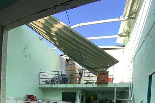 Rò rỉ khí gas trong phòng trọ đóng kín làm nổ tung, cô gái bỏng nặng
