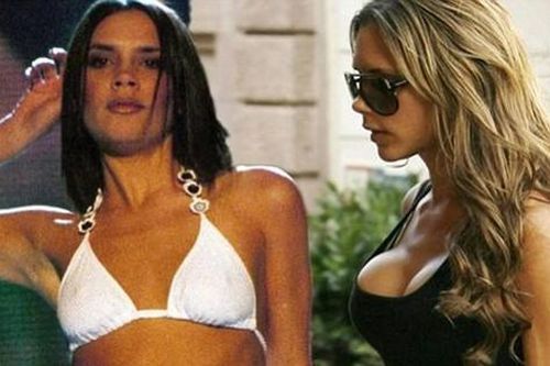 Victoria Beckham, Bella Hadid hối hận vì phẫu thuật thẩm mỹ