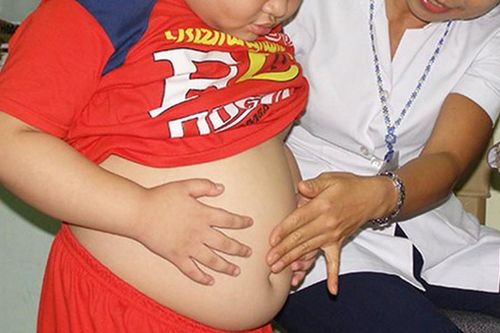Bác sĩ đau đầu vì nhiều phụ huynh nghĩ con béo phì, số cân thừa là 'của để dành'