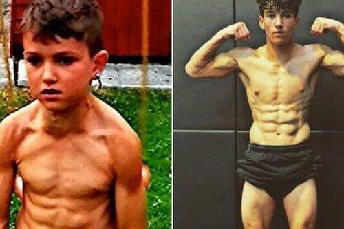 Ngày ấy, bây giờ của 'cậu bé khỏe nhất thế giới'