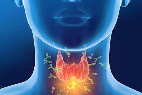 Nguyên nhân gây hội chứng suy giáp