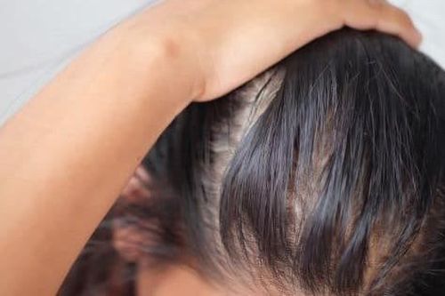Khắc phục tóc đổ dầu hiệu quả bằng muối biển