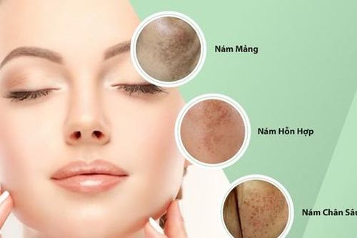 Khám phá bí quyết mờ nám của chị em sau tuổi 30